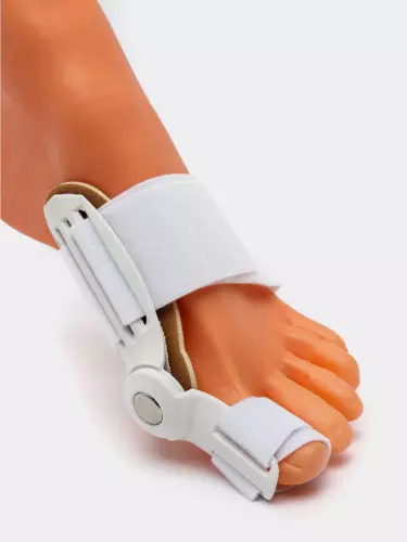 Valgus shinalari, oyoq bosh barmog'i tuzatuvchisi Hallux Valgus