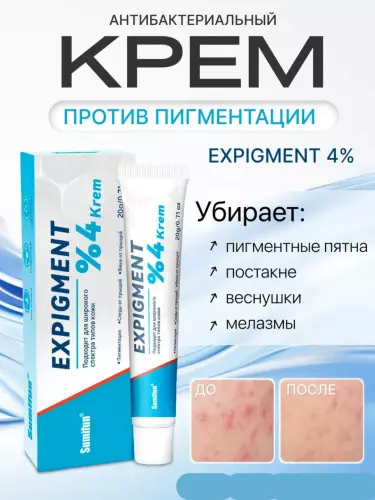 Крем отбеливающий Expigment 4%, мазь для лица от пигментации мелазмы и веснушек, 20 г